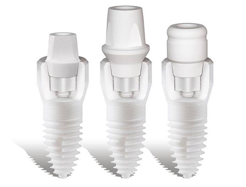 Keramikimplantate Bielefeld